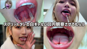 街角で声をかけて口内観察させてもらう はるのちゃん